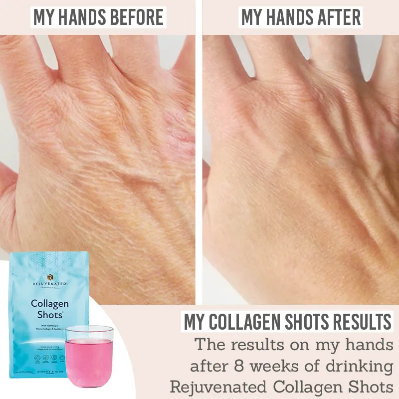 Collagen Shots