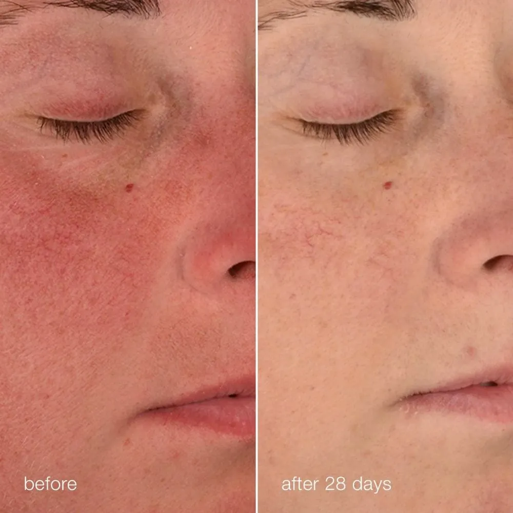 Dermalogica Stabilizing Repair Cream