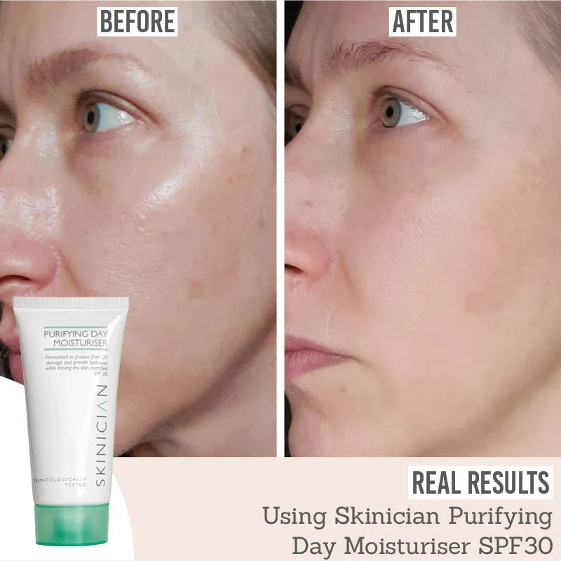 Purifying Day Moisturiser SPF 30