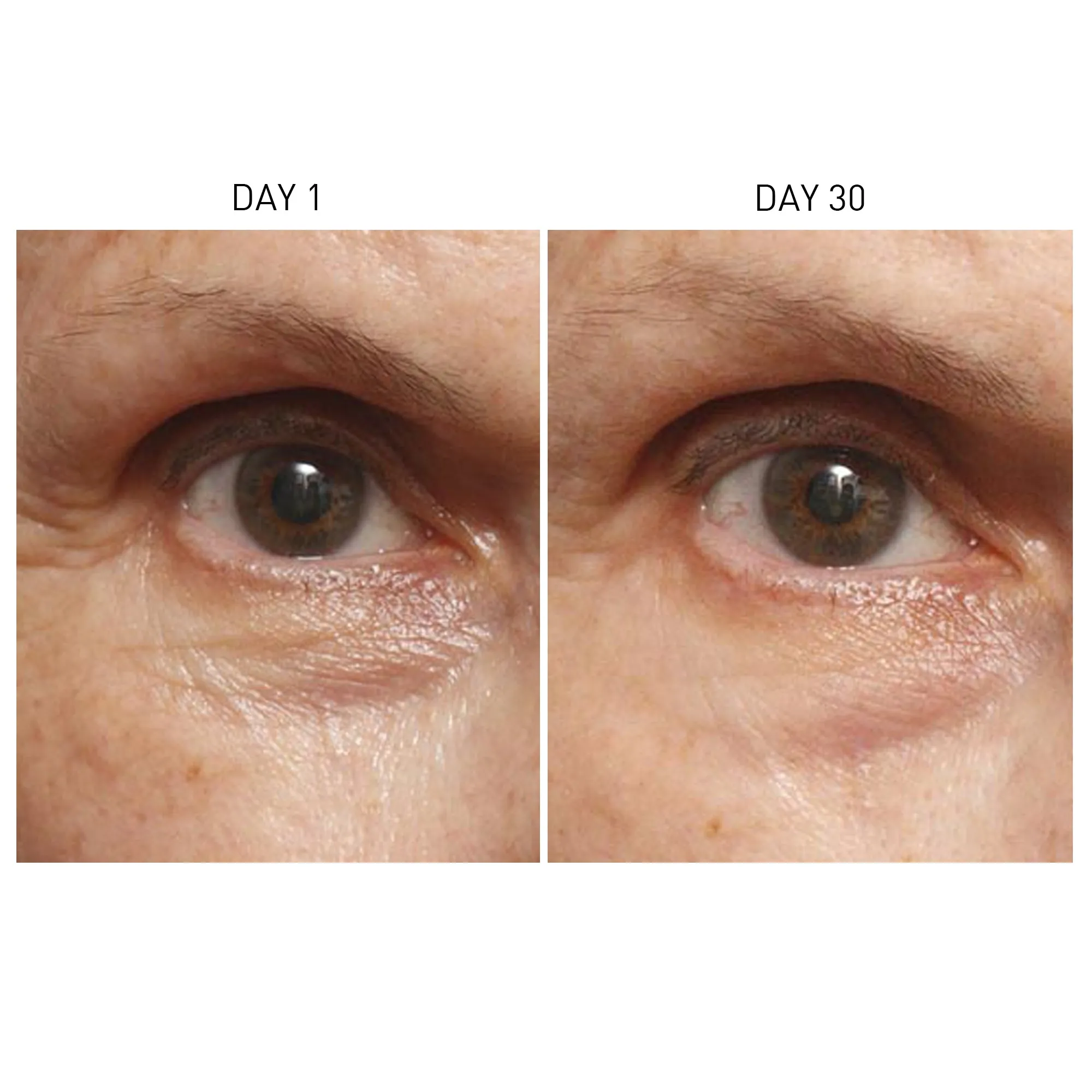 Skyn Iceland Icelandic Relief Eye Cream