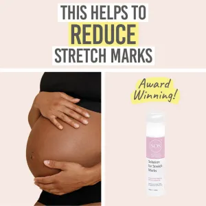 Solution for Stretch Marks